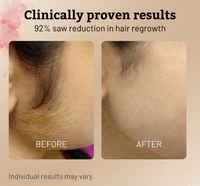 Auréa Cyperus Rotundus Oil🌿